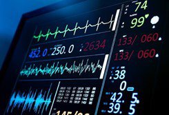ECG Picture.jpg